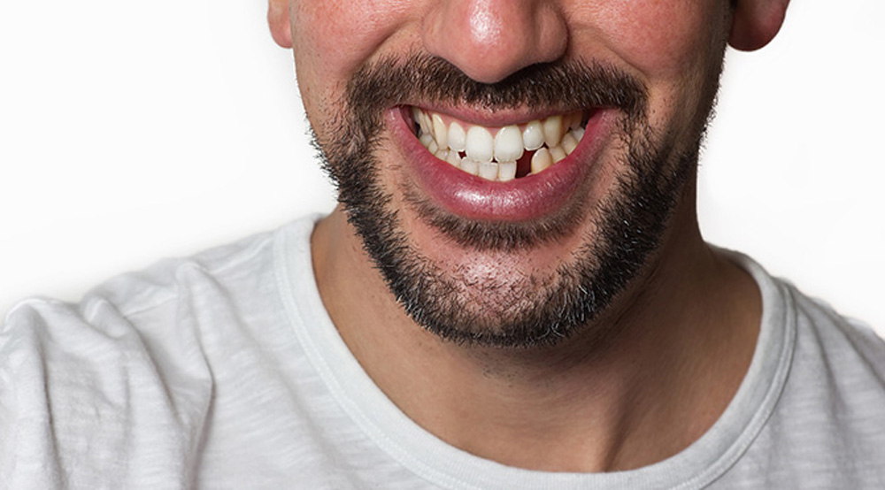 Diş Kaybı İçin Alınabilecek Önlemler