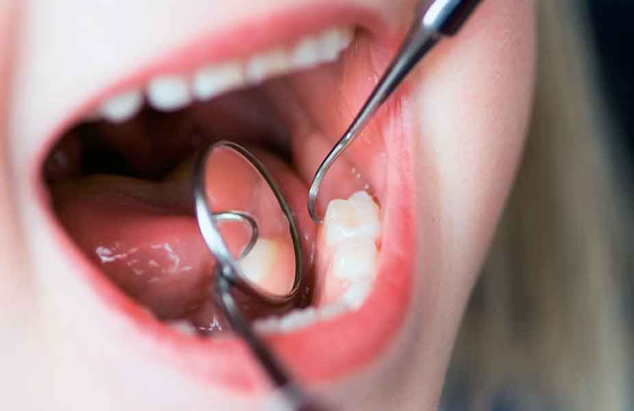 İltihaplı Diş Çekilmeli Mi ?