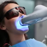 Diş Beyazlatmanın Etkisi ve Süresi: Kapsamlı Bir İnceleme